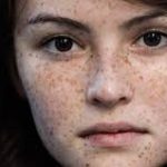 SKIN CARE, SKIN DISEASES