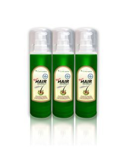 Best Herbal Hair Loss Treatment Hair Oil 300mls – Fast Regrowth